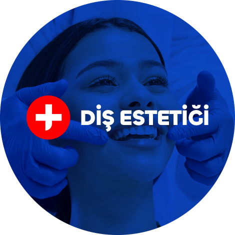 tedavi-hizmetleri-dis-estetigi-a2