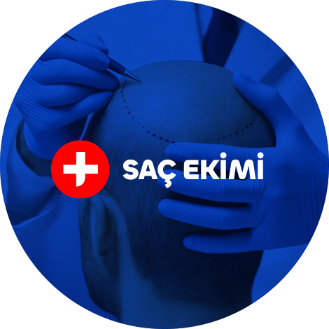 tedavi-hizmetleri-sac-ekimi-a1