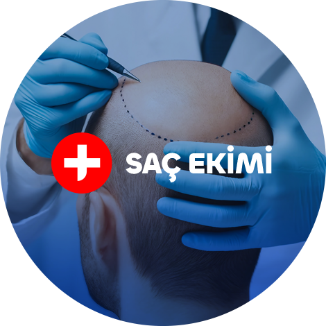 tedavi-hizmetleri-sac-ekimi-aa1